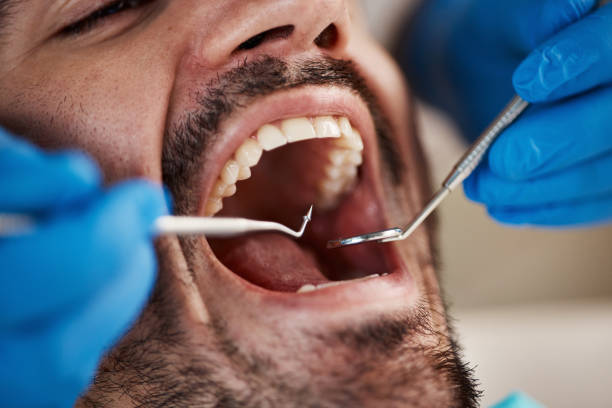 Best Emergency Treatment for Toothache in Clyde, NC